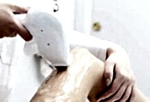 Lazer Epi̇lasyon Tedavi̇si̇ Sonrası İz Kalır mı? Leke ve Yani Ri̇ski̇ Var Mı?